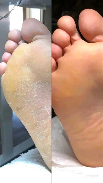 Pédicure chaude vernis gel en promo