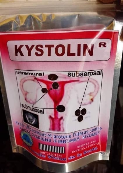 Traitement pour myomes et kystes