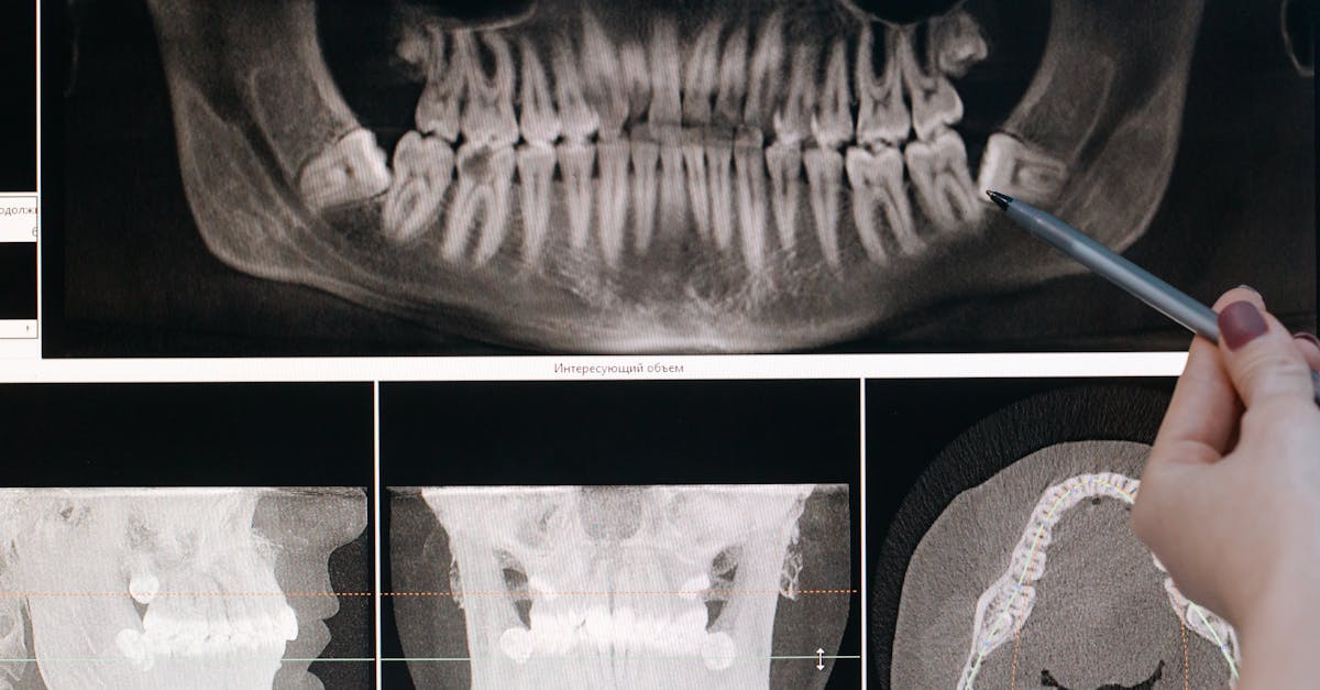 Mobile Dental Units