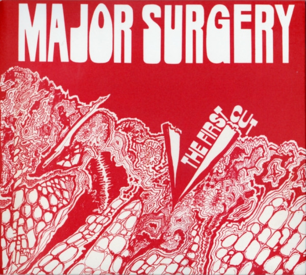 MAJOR SURGERY — THE FIRST CUT