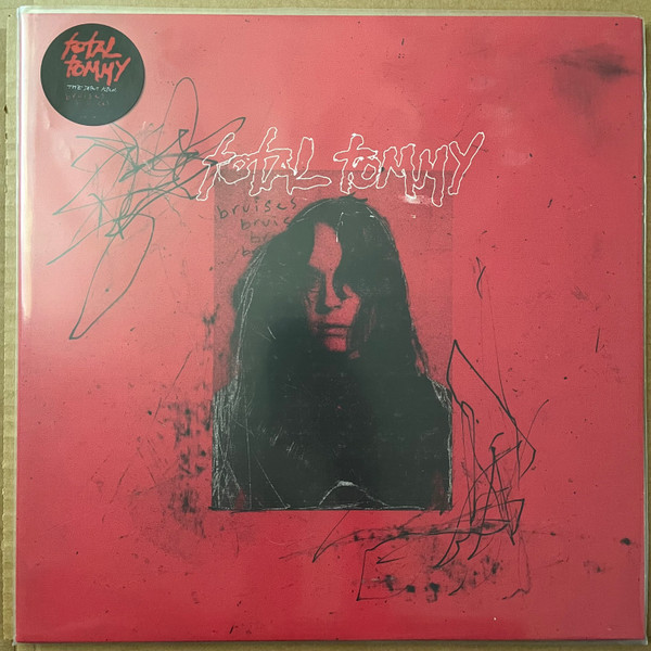 TOTAL TOMMY — BRUISES