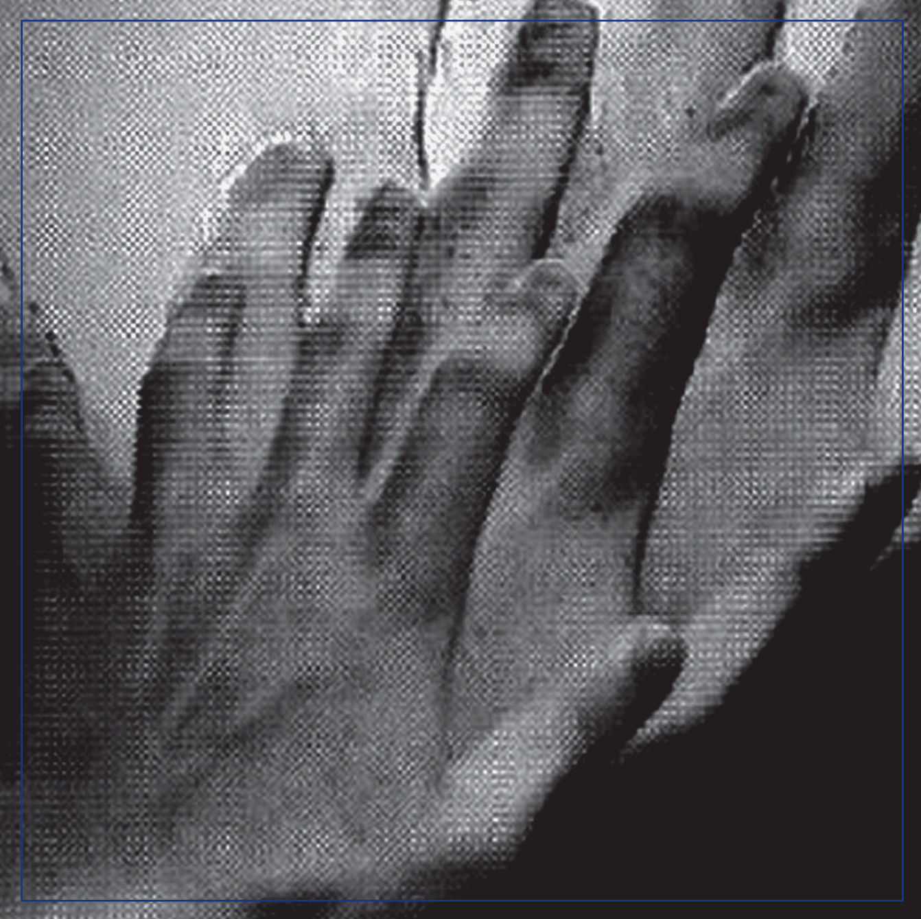 PAINTED CAVES — SURVEILLANCE